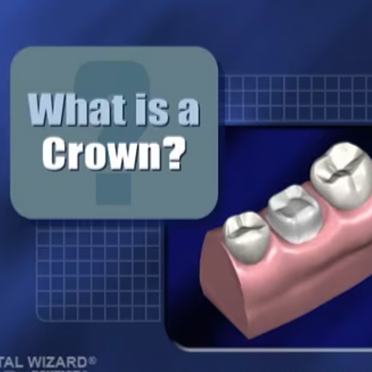 What is a Dental Crown?