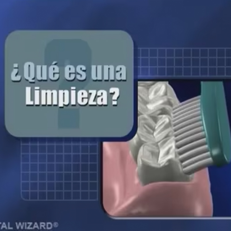What is a Dental Cleaning? (Spanish)