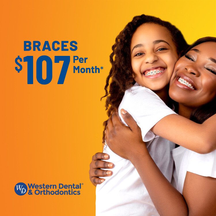 Brackets por $107 al mes* Brackets por $107 al mes*