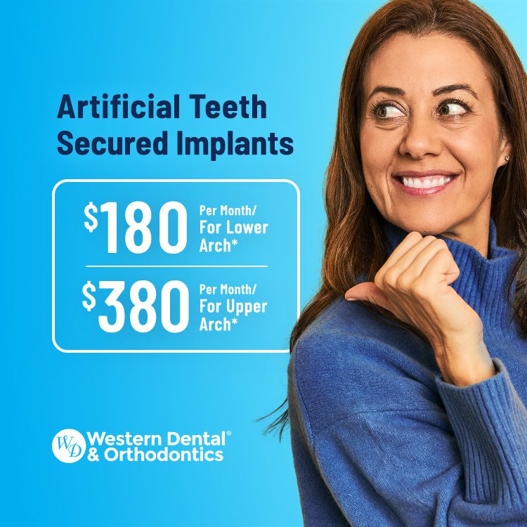 $180 por mes para el arco inferior (precio de venta al público de $7910)* $380 por mes para el arco superior (precio de venta al público de $9040)* $180 por mes para el arco inferior (precio de venta al público de $7910)* $380 por mes para el arco superior (precio de venta al público de $9040)*